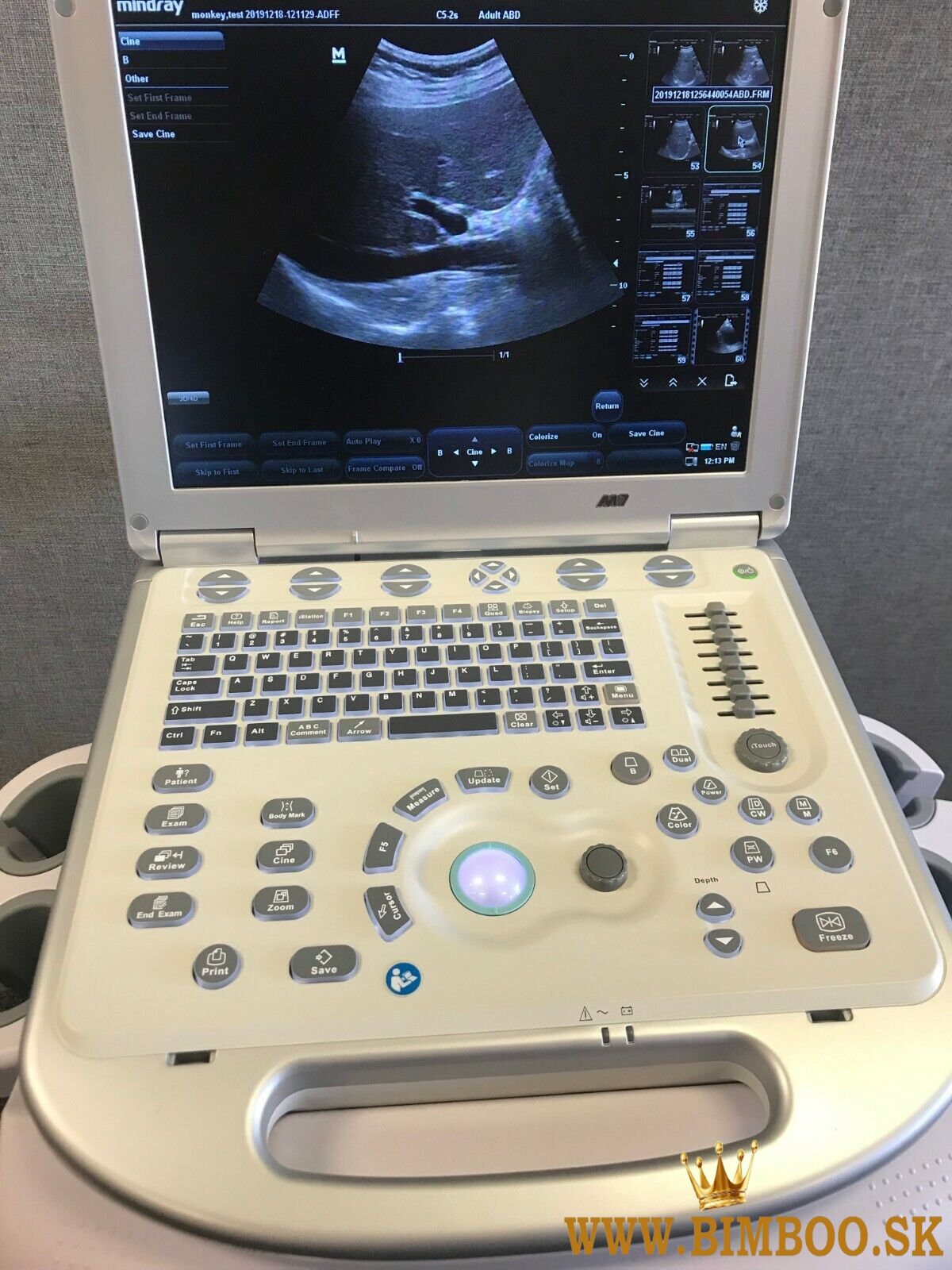 Mindray M7 Ultrasound Machine
